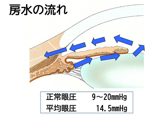 緑内障